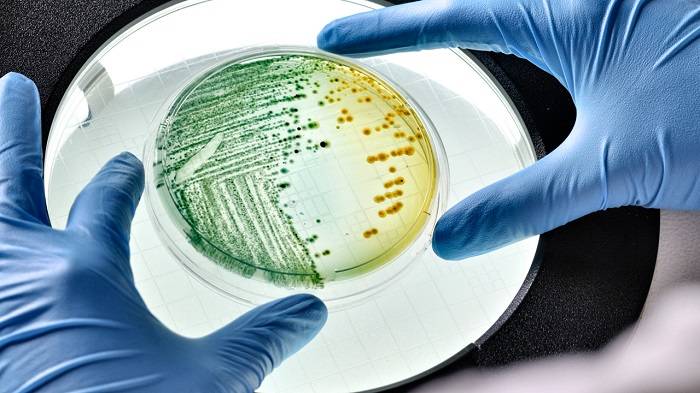 باکتری اشریشیا کلی / Escherichia coli bacteria 