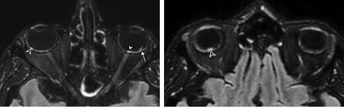 اسکن بیمار کووید / covid patient scan